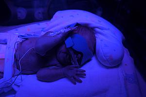 Capri channeling her inner rave spirit. Actually, she's under photo therapy lights to help her get rid of bilirubin to eliminate her jaundice.